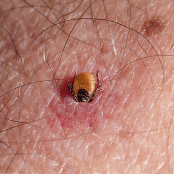 Lyme disease treatment